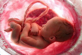 آمار سالانه سقط‌های غیرقانونی اعلام شد/ هزینه سقط جنین غیرقانونی از ۱۰ تا ۱۵۰ میلیون تومان
